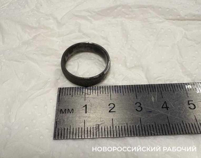 В Новороссийске извлекли «корзинкой» кольцо из детского желудка