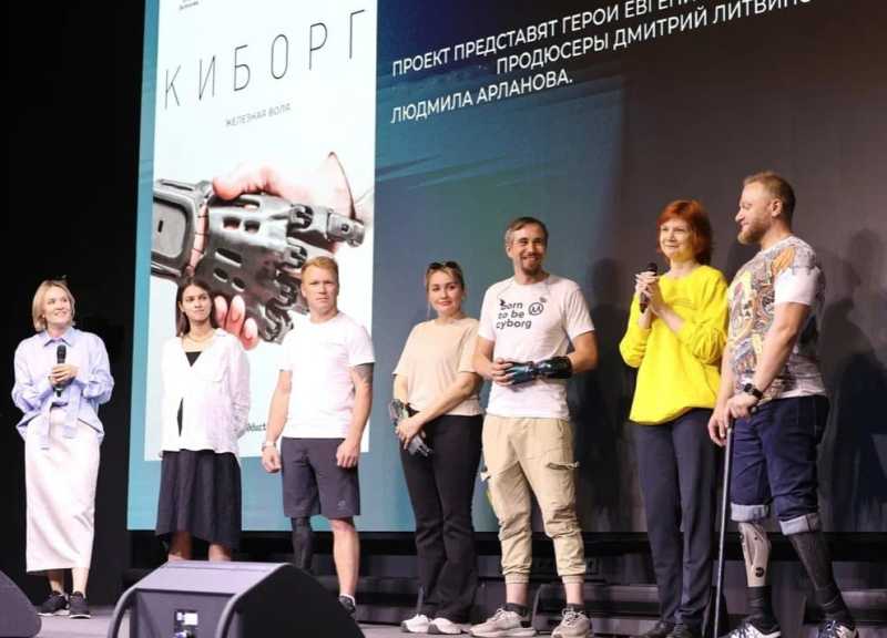 Анна Белова: «Если начинают пялиться, — разворачиваю протез так, чтобы было удобно все рассмотреть»