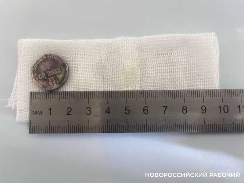 В Новороссийске сачком поймали очередную батарейку в детском желудке