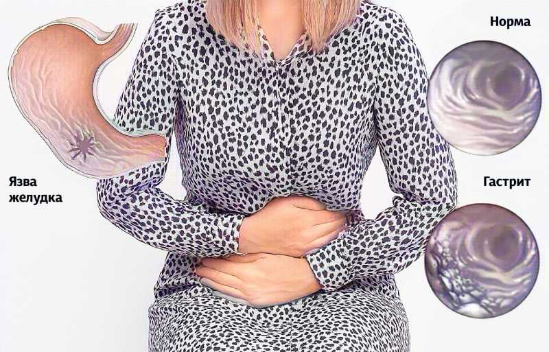 Когда болит где-то тут&hellip; Как уберечь себя