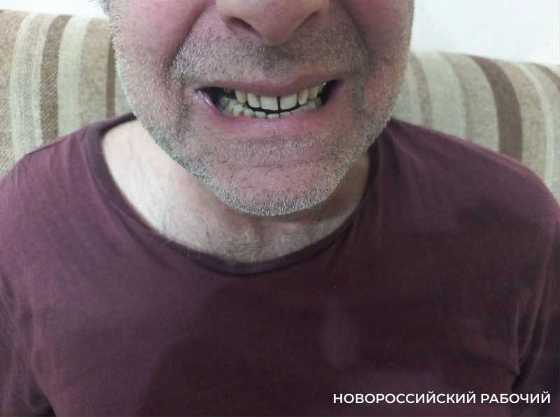 Лже-стоматологи против налоговой. В Новороссийске будут судить мошенников